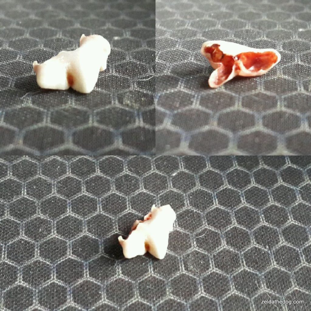 tooth fallen